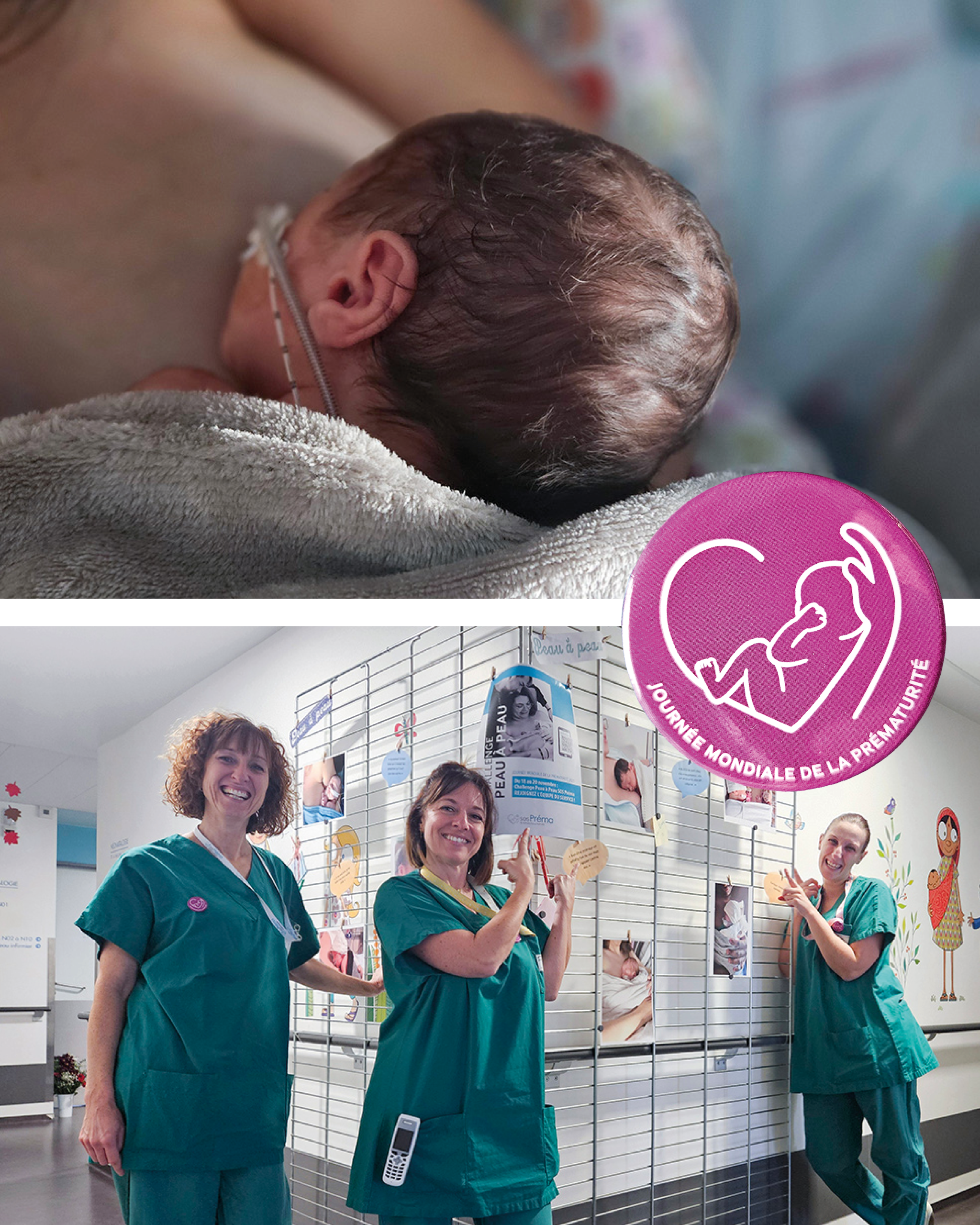 Challenge peau à peau aux Hôpitaux Civils de Colmar à l'occasion de la journée mondiale de la prématurité.